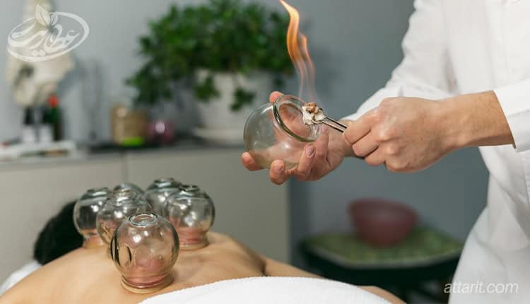 خون دادن بهتره یا حجامت؟